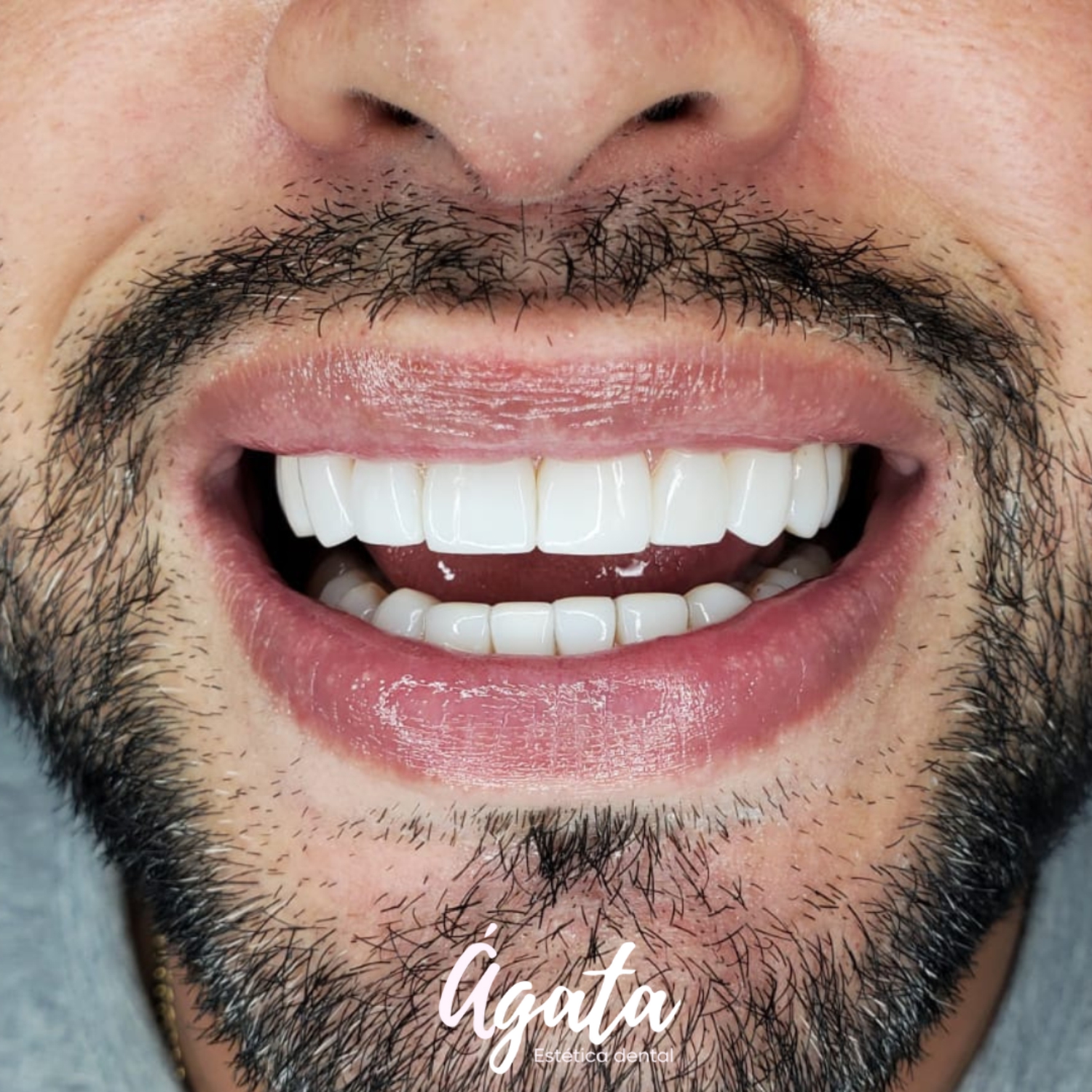 agata estetica dental